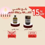بكج علاجي للتساقط و اطالة الشعر السدر الزيتي+زيت علاجي