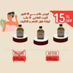 كورس علاجي 6 اسهر من الزيت العلاجي 3 علب لزيادة طول الشعر و كثافتة